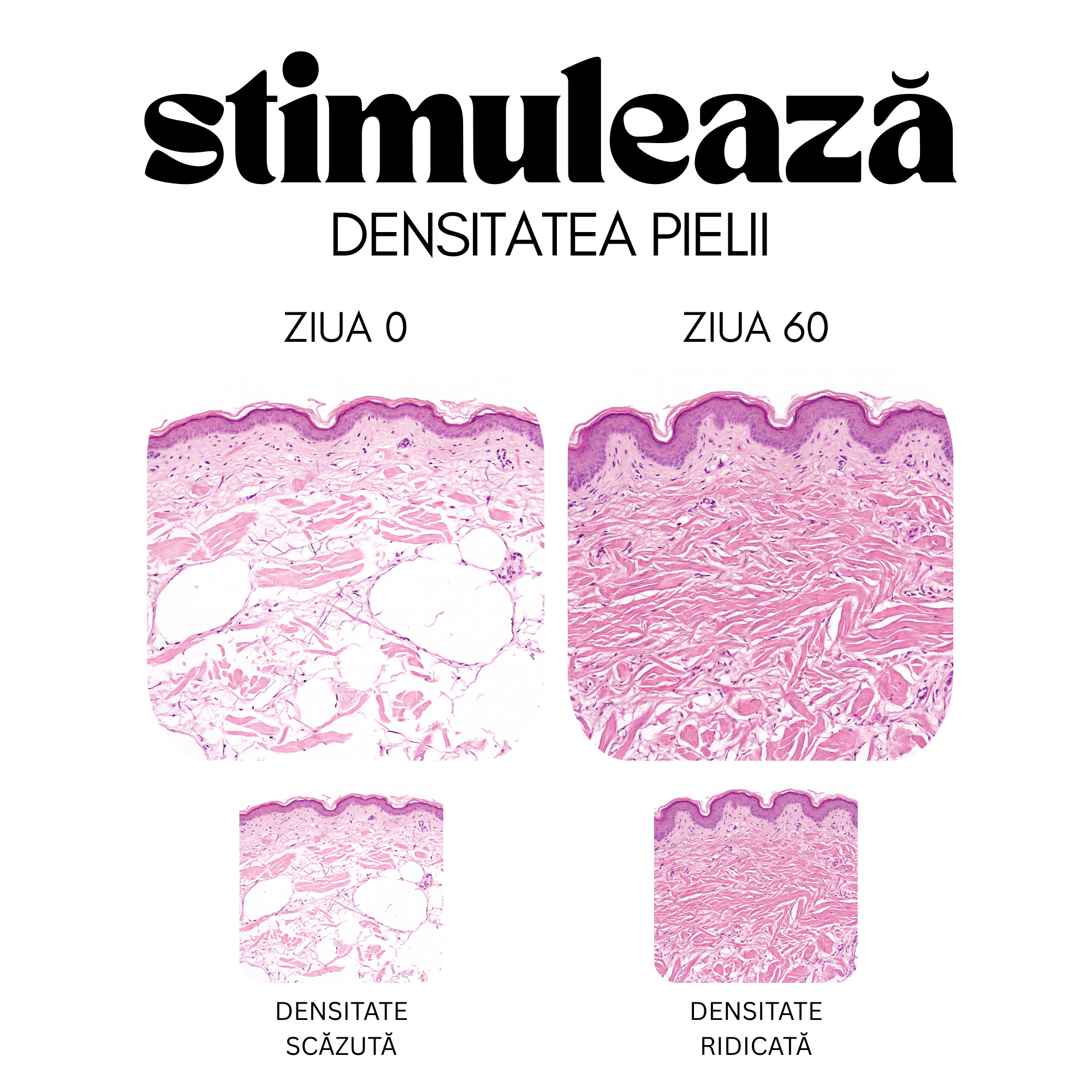 vital 8 - colagen cu acid hialuronic